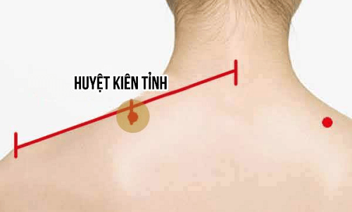 Cách bấm huyệt chữa thoái hóa đốt sống cổ với 4 huyệt đạo