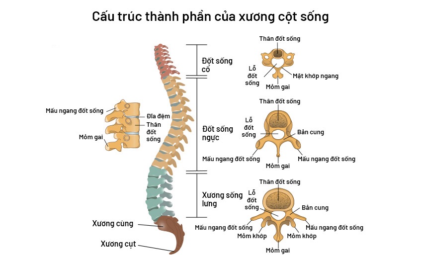 Đau lưng không cúi được